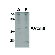 Anti-ATOH8 (RABBIT) Antibody, 100µg, Liquid (sterile filtered)