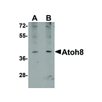 Anti-ATOH8 (RABBIT) Antibody, 100µg, Liquid (sterile filtered)