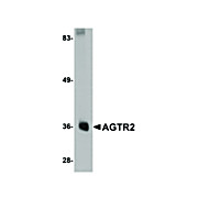 Anti-AGTR2 (RABBIT) Antibody, 100µg, Liquid (sterile filtered)