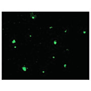 ACINUS - cterm p17 Antibody 100µg