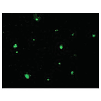 ACINUS - cterm p17 Antibody 100µg