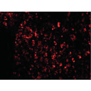 AVEN nterm Antibody 100µg