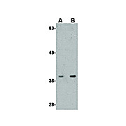 Anti-ALDH3A2 (RABBIT) Antibody, 100µg, Liquid (sterile filtered)