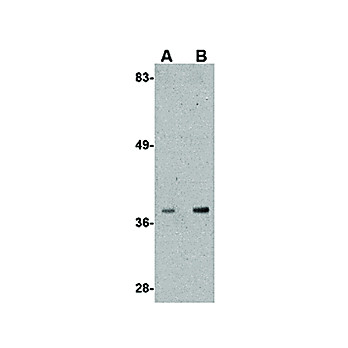 Anti-ALDH3A2 (RABBIT) Antibody, 100µg, Liquid (sterile filtered)