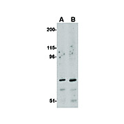 Anti-ASAH2 (RABBIT) Antibody, 100µg, Liquid (sterile filtered)