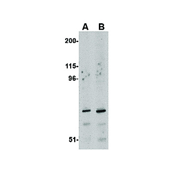 Anti-ASAH2 (RABBIT) Antibody, 100µg, Liquid (sterile filtered)
