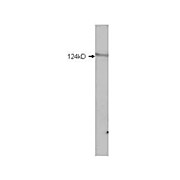 HDAC5 (6 internal) Antibody 100µg