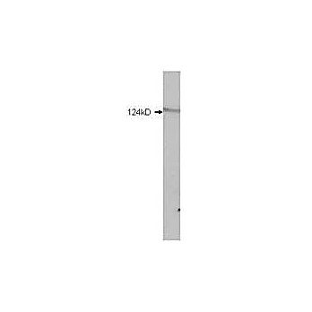 HDAC5 (6 internal) Antibody 100µg