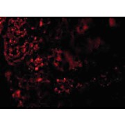 Anti-AGTR1 (RABBIT) Antibody, 100µg, Liquid (sterile filtered)
