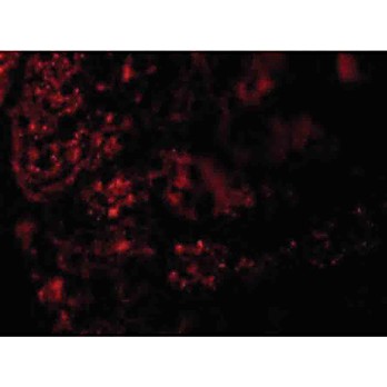 Anti-AGTR1 (RABBIT) Antibody, 100µg, Liquid (sterile filtered)