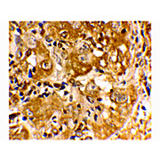 BIM nterm Antibody 100µg