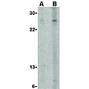 Anti-APRIL (RABBIT) Antibody, 100µg, Liquid (sterile filtered)