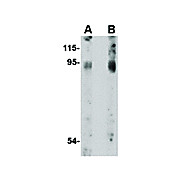 BICD2 cterm Antibody 100µg