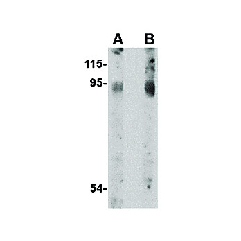 BICD2 cterm Antibody 100µg