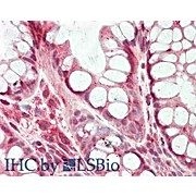 HDAC5 (2 internal) Antibody 100µg