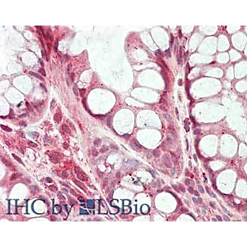 HDAC5 (2 internal) Antibody 100µg