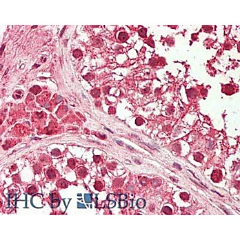 HDAC10 (near N-terminus) Antibody 100µg