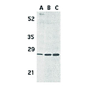 Anti-BCMA (RABBIT) Antibody, 100µg, Liquid (sterile filtered)