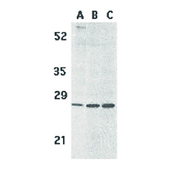 Anti-BCMA (RABBIT) Antibody, 100µg, Liquid (sterile filtered)