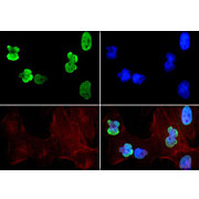 Anti-Histone H3 [ac Lys9, ac Lys14] (RABBIT) Antibody, 50µg, Liquid (sterile filtered)