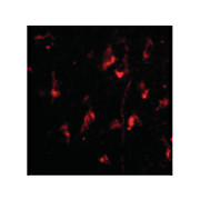 ATG12 nterm Antibody 100µg