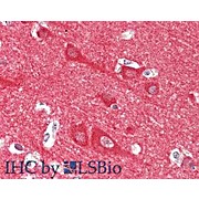 Anti-Neuronal Calcium Sensor 1 (RABBIT) Antibody, 100µg, Liquid (sterile filtered)