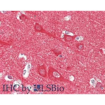 Anti-Neuronal Calcium Sensor 1 (RABBIT) Antibody, 100µg, Liquid (sterile filtered)