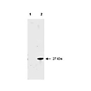 Anti-RFP (RABBIT) Antibody Peroxidase Conjugated Min X Hu Ms and Rt Serum Proteins, 100µg, Lyophilized