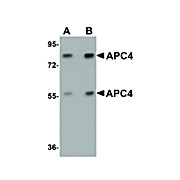 Anti-APC4 (RABBIT) Antibody, 100µg, Liquid (sterile filtered)