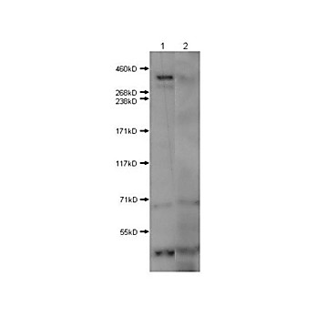 Huntington Antibody nterm 100µg