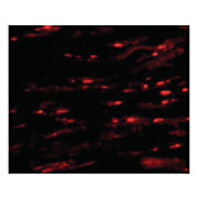 Anti-ASAH1 (RABBIT) Antibody, 100µg, Liquid (sterile filtered)