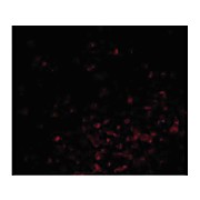 BAG1 nterm Antibody 100µg