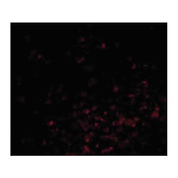 BAG1 nterm Antibody 100µg