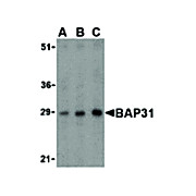 BAP31 internal Antibody 100µg