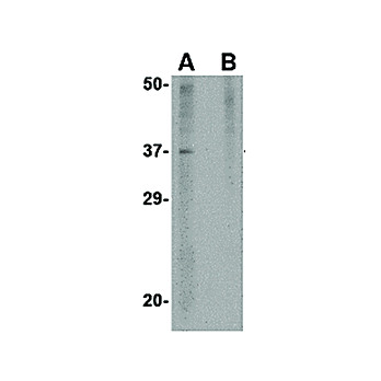 AKIRIN2 internal Antibody 100µg