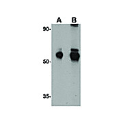 Anti-ALDH5A1 (RABBIT) Antibody, 100µg, Liquid (sterile filtered)