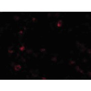 AIM nterm Antibody 100µg