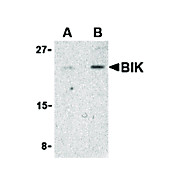 BIK Antibody 100µg