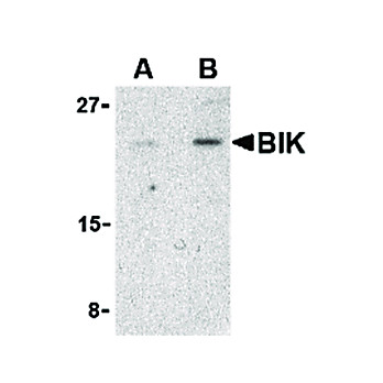 BIK Antibody 100µg