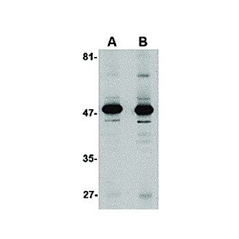 Anti-ALDH3A1 (RABBIT) Antibody, 100µg, Liquid (sterile filtered)