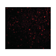 Anti-BRSK2 (RABBIT) Antibody, 100µg, Liquid (sterile filtered)