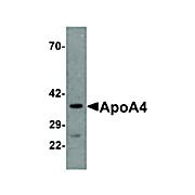 APOLIPOPROTEIN A-IV cterm Antibody 100µg