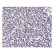 Anti-ARL15 (RABBIT) Antibody, 100µg, Liquid (sterile filtered)