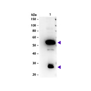 Anti-GUINEA PIG IgG (H&L) (RABBIT) Antibody Peroxidase Conjugated, 2mg, Lyophilized
