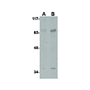 Rb AAK1 Antibody- cterm 100µg
