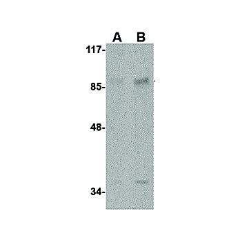 Rb AAK1 Antibody- cterm 100µg