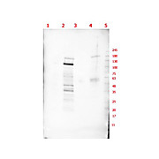 Anti-p130 (RABBIT) Antibody, 100µg, Liquid (sterile filtered)