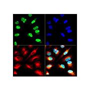 Anti-Histone H3 [ac Lys9/phospho Ser10] (RABBIT) Antibody, 50µg, Liquid (sterile filtered)
