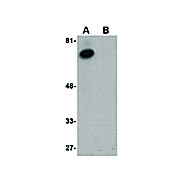 Anti-ACVR1B (RABBIT) Antibody, 100µg, Liquid (sterile filtered)