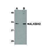 Anti-ALKBH2 (RABBIT) Antibody, 100µg, Liquid (sterile filtered)